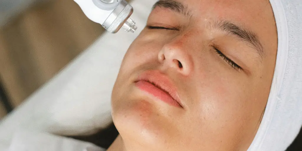 Helix CO2 Laser - Northvilla Beauty Spa