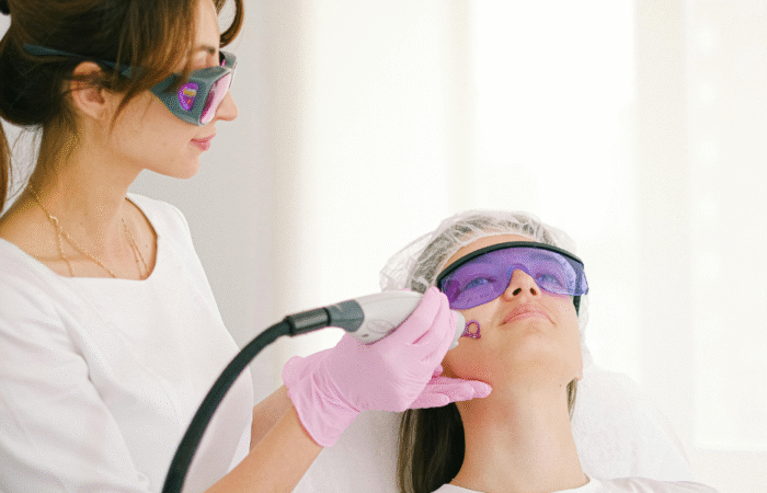 Co2 Laser Downtime: How Can You Speed Up Healing After Co2 Laser - Northvilla Beauty Spa