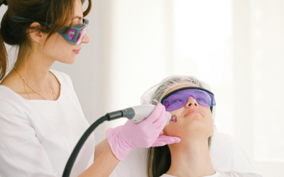 Co2 Laser Downtime: How Can You Speed Up Healing After Co2 Laser