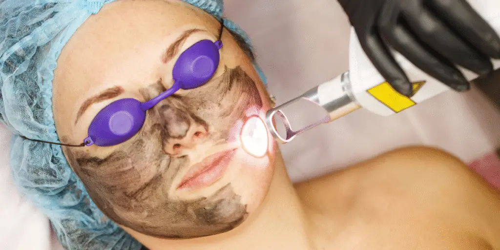 Helix CO2 Laser  - Northvilla Beauty Spa