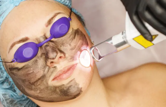 Helix CO2 Laser - Northvilla Beauty Spa
