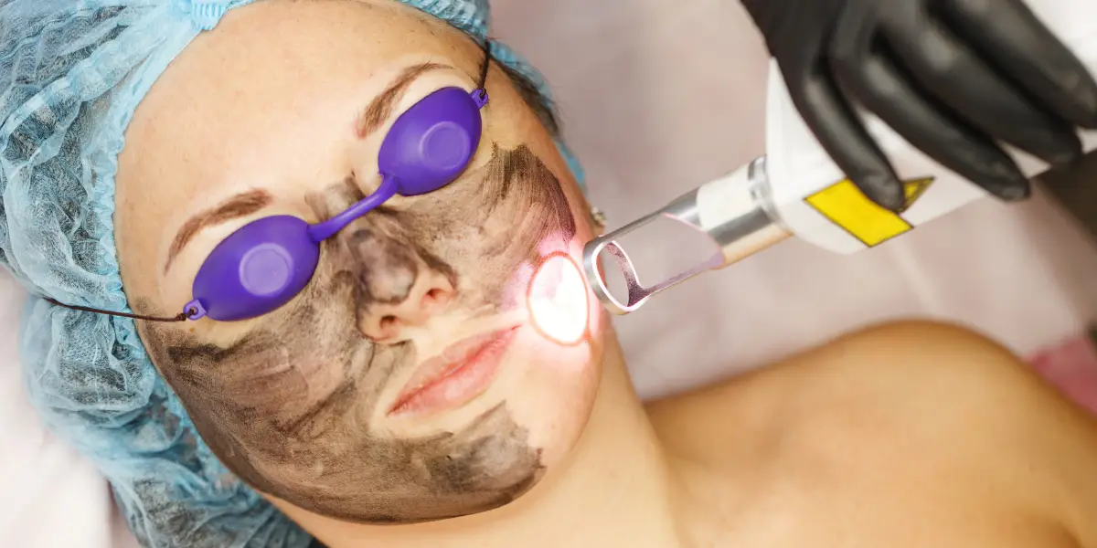 Helix CO2 Laser  - Northvilla Beauty Spa