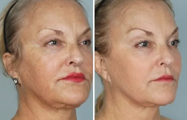 Special Offers - Northvilla Beauty Spa