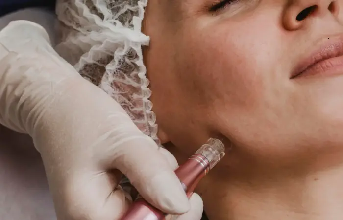 CO₂ Laser vs Microneedling: Comparing Results, Cost, and Recovery - Northvilla Beauty Spa