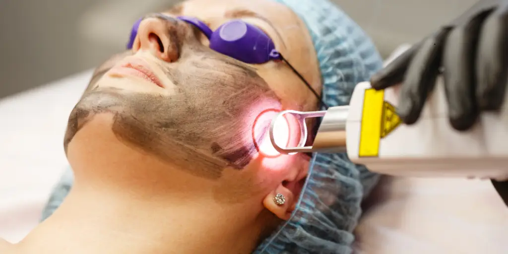 CO₂ Laser vs Microneedling: Comparing Results, Cost, and Recovery - Northvilla Beauty Spa