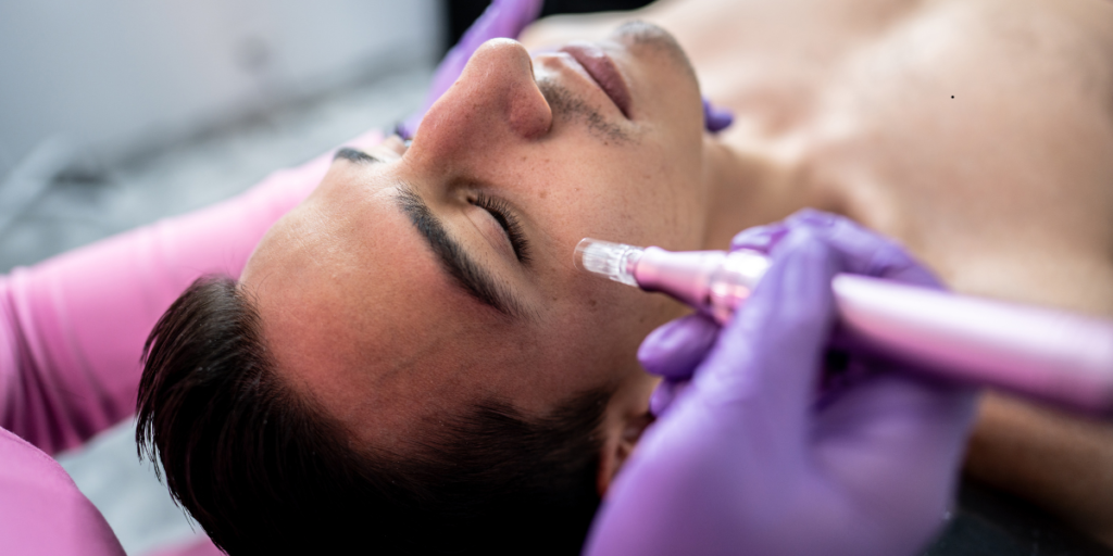 CO₂ Laser vs Microneedling: Comparing Results, Cost, and Recovery - Northvilla Beauty Spa