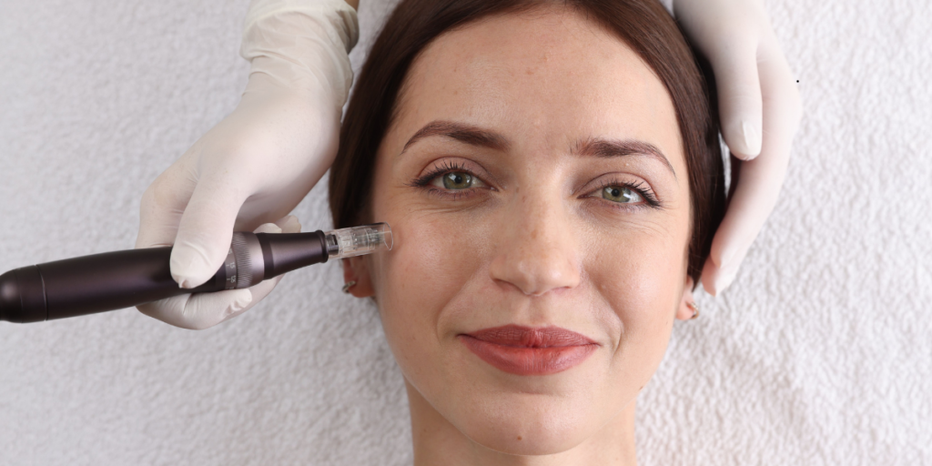 Your Step by Step EXION RF Microneedling Results Timeline - Northvilla Beauty Spa