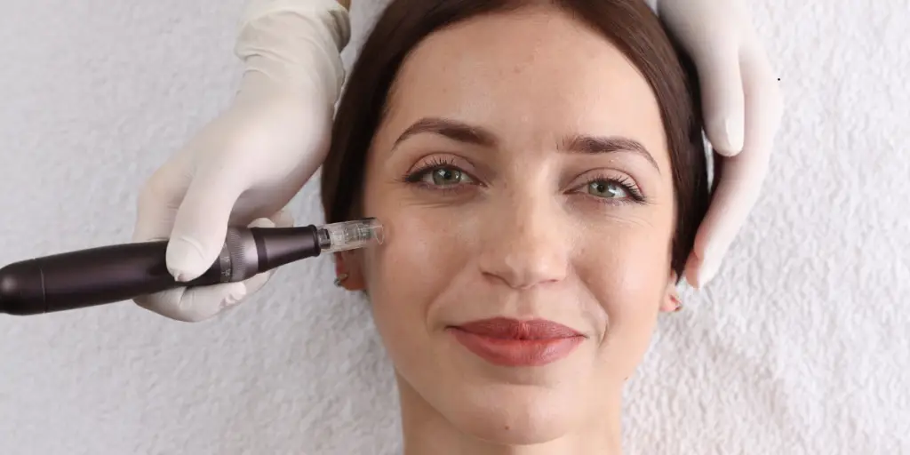 Your Step by Step EXION RF Microneedling Results Timeline - Northvilla Beauty Spa