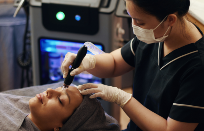 Your Step by Step EXION RF Microneedling Results Timeline - Northvilla Beauty Spa