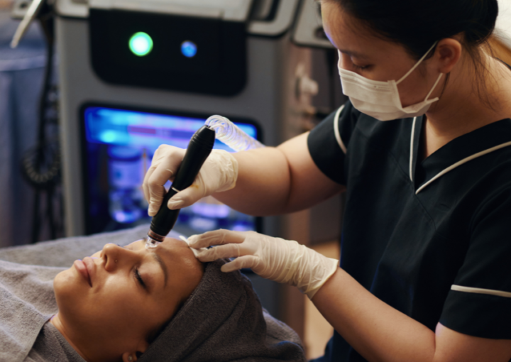 Your Step by Step EXION RF Microneedling Results Timeline - Northvilla Beauty Spa