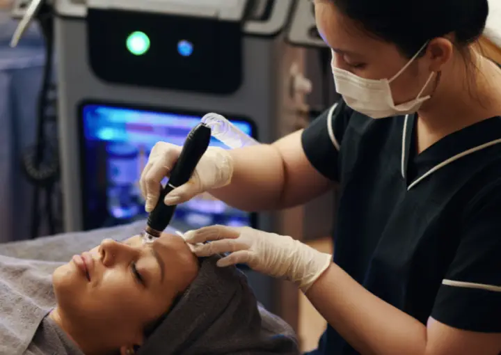 Your Step by Step EXION RF Microneedling Results Timeline - Northvilla Beauty Spa