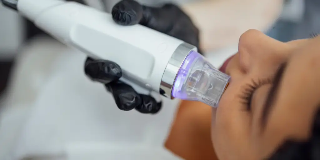 Your Step by Step EXION RF Microneedling Results Timeline - Northvilla Beauty Spa