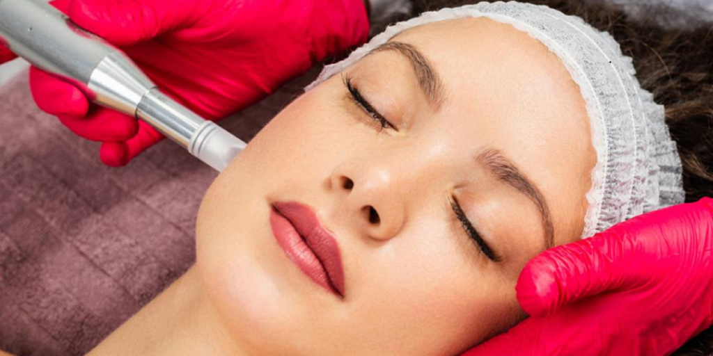 Your Step by Step EXION RF Microneedling Results Timeline - Northvilla Beauty Spa