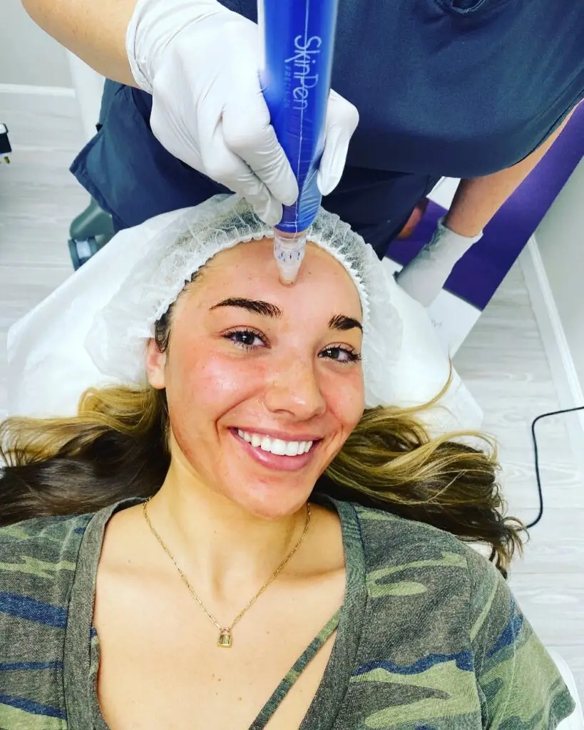 Microneedling Showdown: SkinPen vs EXION RF Microneedling – Which Is Right For You? - Northvilla Beauty Spa
